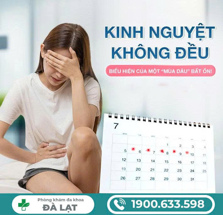 Hình ảnh minh họa
