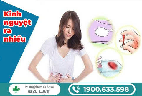 Hình ảnh minh họa