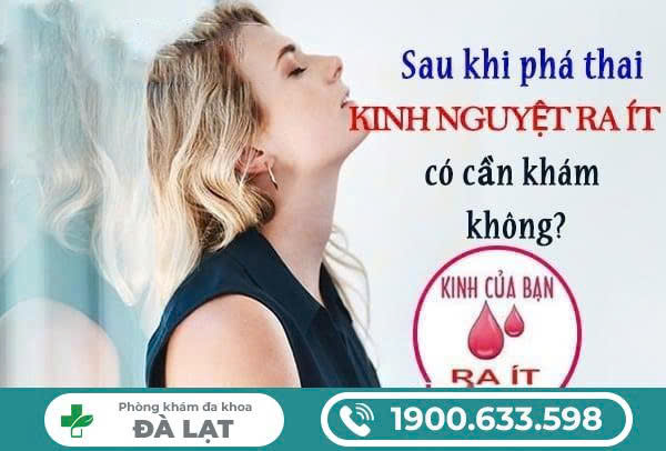 Hình ảnh minh họa