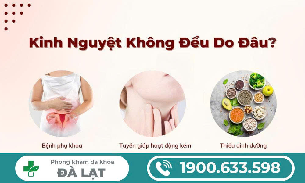Hình ảnh minh họa