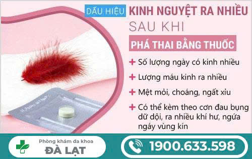 Hình ảnh minh họa
