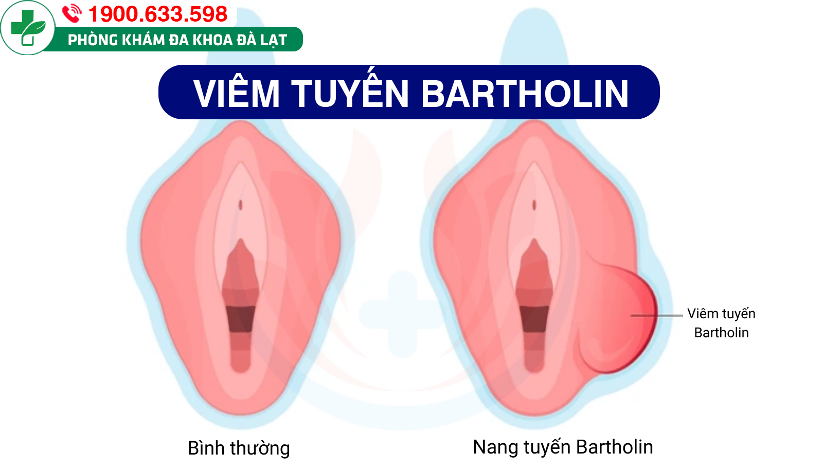 Hình ảnh minh họa