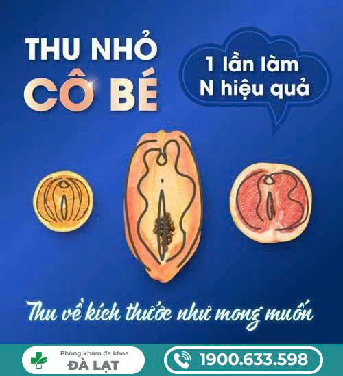 Hình ảnh minh họa