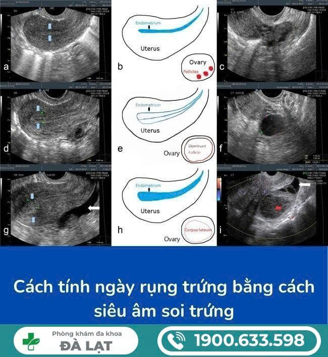 Hình ảnh minh họa