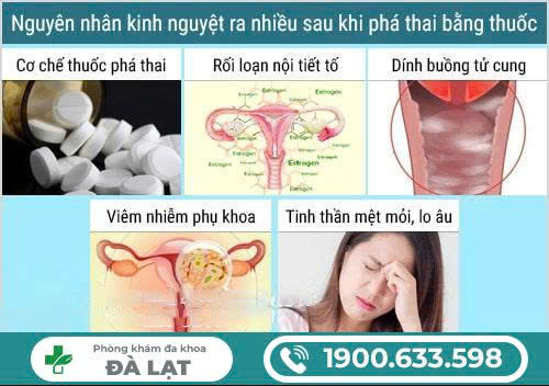 Hình ảnh minh họa